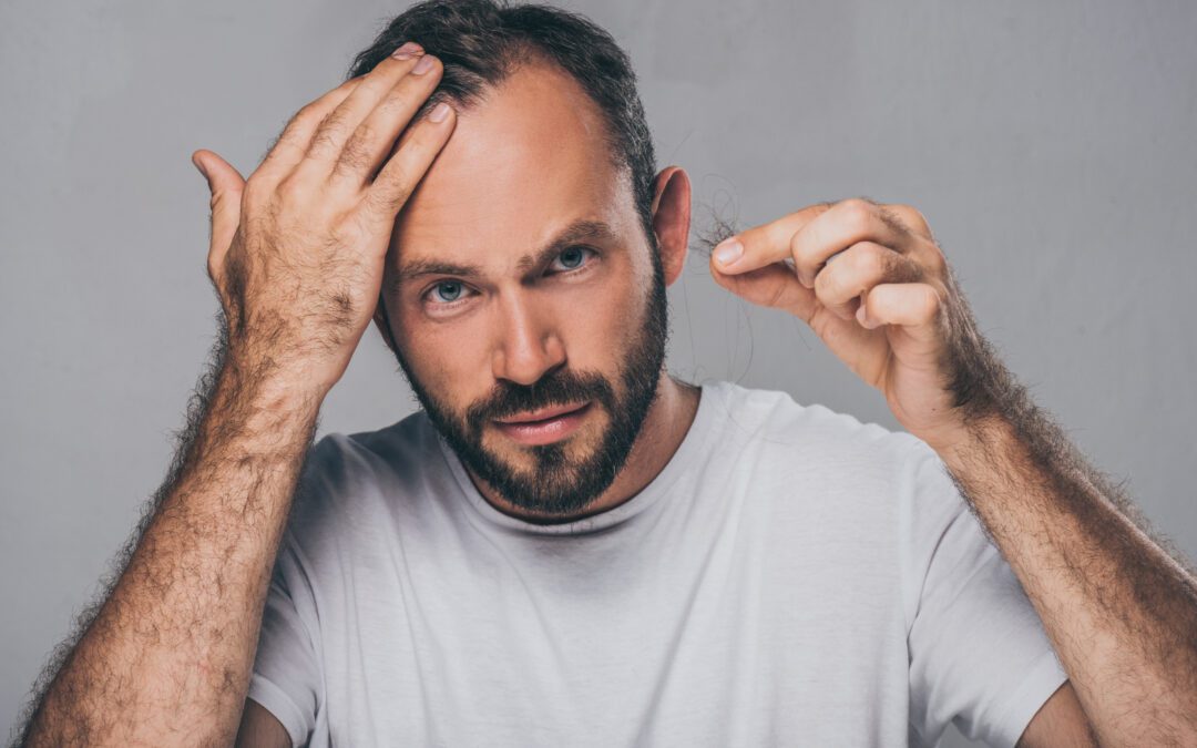 Hair Loss and Hair Transplants in Mauritius: What Are the Frequently Asked Questions?